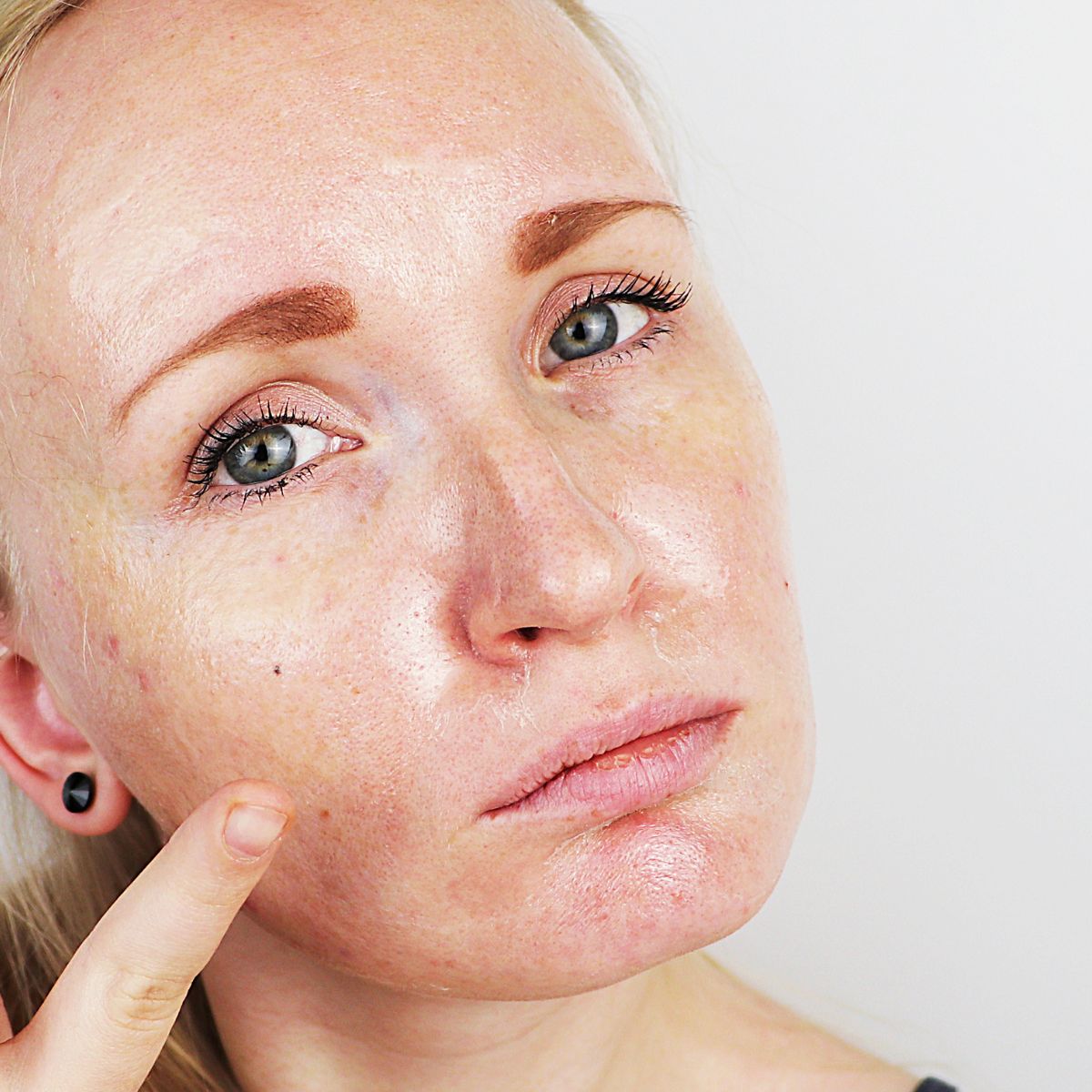 How To Treat Oily Skin Blog Topicals