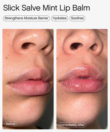 best hydrating lip balm