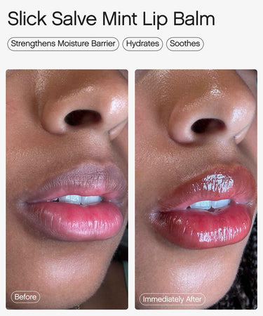 best hydrating lip balm