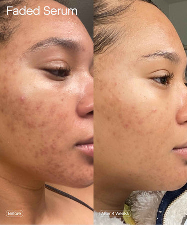 face brightening serum