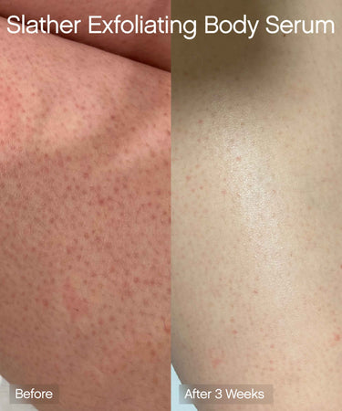 Slather Exfoliating Body Serum