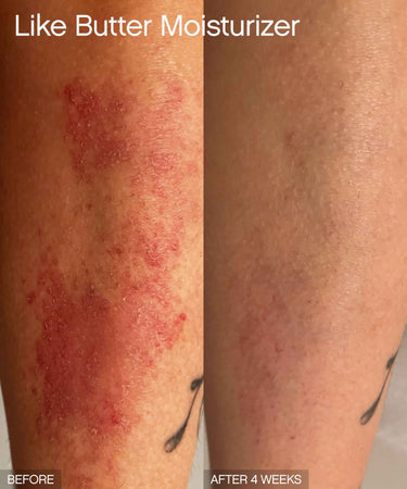 Discoloration Duo