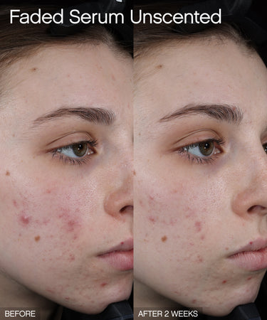 Faded Brightening + Clearing Serum (Unscented)