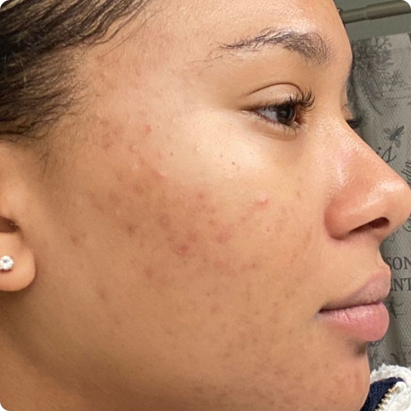 Serum For Discoloration & Dark Spots- Faded Serum | Topicals